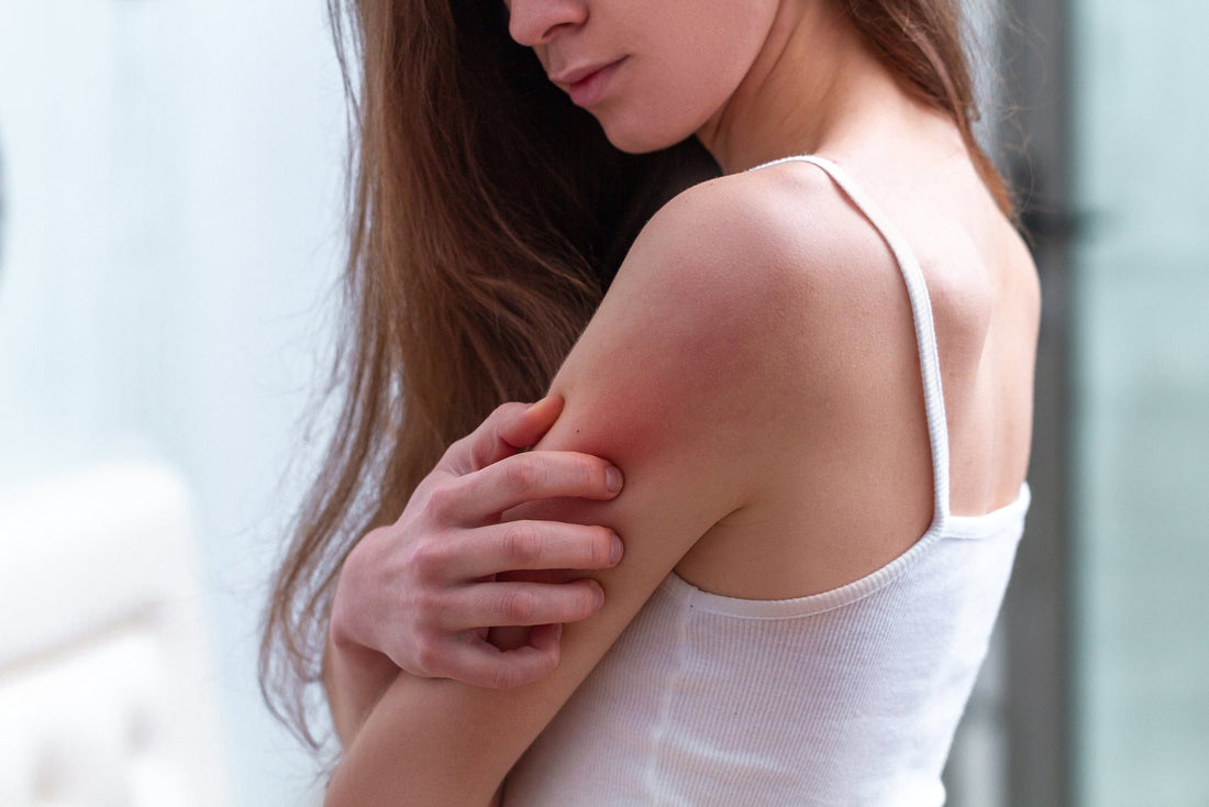 A woman scratches eczema on her arm. Organic eczema lotion can have many powerful impacts on managing the itchy irritation of eczema. Learn more in our complete guide.