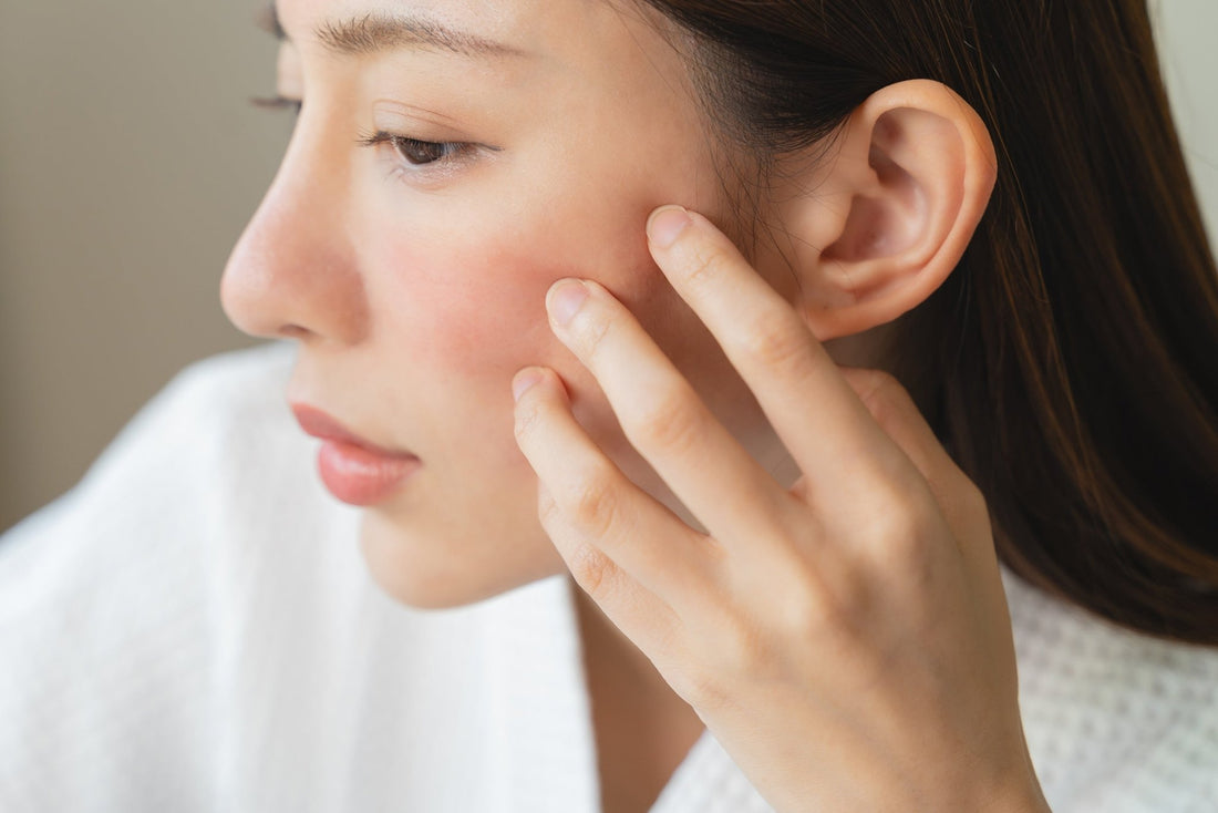 A woman looks at irritated skin on her face. Learn why Yay for Earth's Hydrosol Spritzie is the best toner for rosacea, crafted with soothing all natural ingredients to calm the skin.